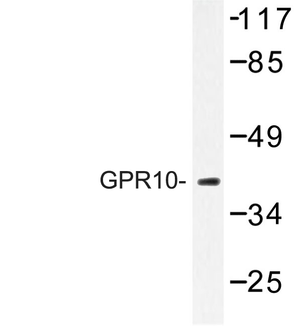 Western blot of GPR10 (Q223) pAb in extracts from Jurkat cells.