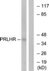 Western blot of extracts from Jurkat cells, using PRLHR Antibody. The lane on the right is treated with the synthesized peptide.