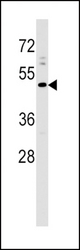 PRLHR Antibody western blot of A2058 cell line lysates (35 ug/lane). The PRLHR antibody detected the PRLHR protein (arrow).