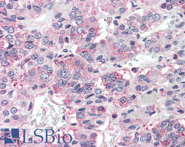 Anti-PRLHR / GPR10 antibody LS-A1088 IHC of human pituitary. Immunohistochemistry of formalin-fixed, paraffin-embedded tissue after heat-induced antigen retrieval.