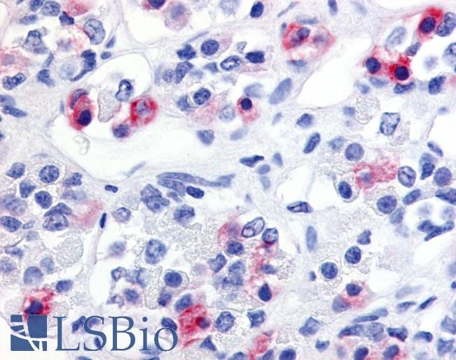 Anti-PRLHR / GPR10 antibody LS-A3821 IHC of human anterior pituitary. Immunohistochemistry of formalin-fixed, paraffin-embedded tissue after heat-induced antigen retrieval.