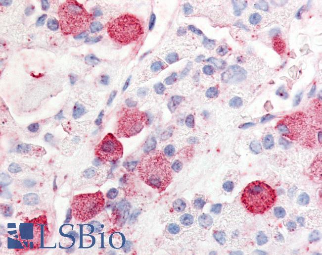 Anti-PRLHR / GPR10 antibody LS-A3825 IHC staining of human anterior pituitary. Immunohistochemistry of formalin-fixed, paraffin-embedded tissue after heat-induced antigen retrieval.