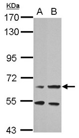 Sample (30 ug of whole cell lysate). A:293T, B: HeLa. 7.5% SDS PAGE. PRLR / Prolactin Receptor antibody diluted at 1:1000.
