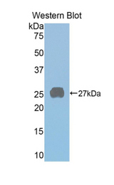 Western blot of recombinant PRLR / Prolactin Receptor.