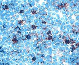 Prolactin R in Rat Thymus. Prolactin R was detected in perfusion fixed frozen sections of rat thymus using Goat Anti-Rat Prolactin R Antigen Affinity-purified Polyclonal Antibody at 15 ug/ml overnight at 4°C. Tissue was stained using Anti-Goat HRP-DAB (brown) and counterstained with hematoxylin (blue). Specific labeling was localized to the cytoplasm of lymphocytes.