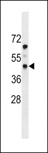 PDGFRL Antibody western blot of mouse heart tissue lysates (35 ug/lane). The PDGFRL antibody detected the PDGFRL protein (arrow).