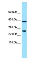 PRLTS / PDGFRL antibody Western Blot of RPMI-8226.