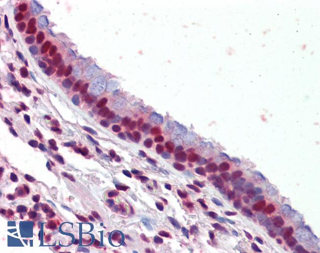 Anti-PRMT1 antibody IHC of human lung, respiratory epithelium. Immunohistochemistry of formalin-fixed, paraffin-embedded tissue after heat-induced antigen retrieval. Antibody LS-B3619 concentration 10 ug/ml.