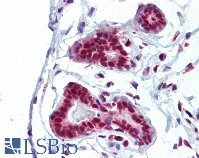 Anti-PRMT1 antibody IHC of human breast. Immunohistochemistry of formalin-fixed, paraffin-embedded tissue after heat-induced antigen retrieval. Antibody LS-B3619 concentration 10 ug/ml.