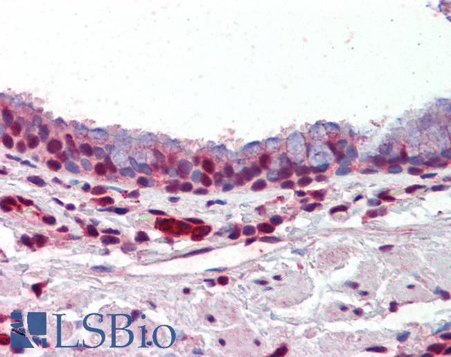 Anti-PRMT1 antibody IHC of human lung, respiratory epithelium. Immunohistochemistry of formalin-fixed, paraffin-embedded tissue after heat-induced antigen retrieval. Antibody LS-B3620 concentration 5 ug/ml.