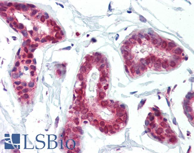 Anti-PRMT1 antibody IHC of human breast. Immunohistochemistry of formalin-fixed, paraffin-embedded tissue after heat-induced antigen retrieval. Antibody LS-B3620 concentration 5 ug/ml.