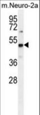 PRMT1 Antibody (C-term K342) western blot of mouse Neuro-2a cell line lysates (35 ug/lane). The PRMT1 antibody detected the PRMT1 protein (arrow).