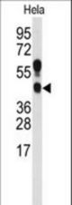 Western blot of anti-PRMT1 Antibody (C-term K342) in HeLa cell line lysates (35 ug/lane). PRMT1 (arrow) was detected using the purified antibody.