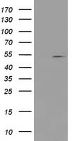 HEK293T cells were transfected with the pCMV6-ENTRY control (Left lane) or pCMV6-ENTRY PRMT2 (Right lane) cDNA for 48 hrs and lysed. Equivalent amounts of cell lysates (5 ug per lane) were separated by SDS-PAGE and immunoblotted with anti-PRMT2.