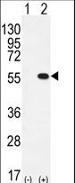 Western blot of PRMT2 (arrow) using rabbit polyclonal PRMT2 Antibody (L359). 293 cell lysates (2 ug/lane) either nontransfected (Lane 1) or transiently transfected (Lane 2) with the PRMT2 gene.