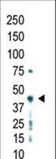 Western blot of anti-PRMT2 antibody in whole HL60 cell lysate was detected using purified antibody. Secondary HRP-anti-rabbit was used for signal visualization with chemiluminescence.