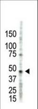 The anti-PRMT2 antibody is used in Western blot to detect PRMT2 in HL60 cell lysate.