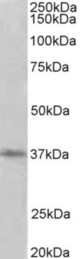 PRMT2 antibody (2 ug/ml) staining of HeLa lysate (35 ug protein in RIPA buffer). Primary incubation was 1 hour. Detected by chemiluminescence.