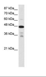 Jurkat Cell Lysate