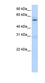 PRMT3 antibody LS-C101829 Western blot of Fetal Muscle lysate.