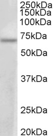 PRMT3 antibody (1 ug/ml) staining of MCF7 lysate (35 ug protein in RIPA buffer). Primary incubation was 1 hour. Detected by chemiluminescence.