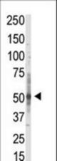 Western blot of anti-PRMT3 antibody in whole HL60 cell lysate: PRMT3 (Arrow) was detected using purified antibody. Secondary HRP-anti-rabbit was used for signal visualization with chemiluminescence.