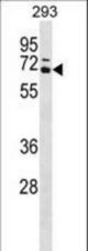 CARM1 Antibody western blot of 293 cell line lysates (35 ug/lane). The CARM1 antibody detected the CARM1 protein (arrow).