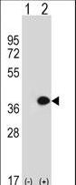 Western blot of MLF1 (arrow) using rabbit polyclonal MLF1 Antibody. 293 cell lysates (2 ug/lane) either nontransfected (Lane 1) or transiently transfected (Lane 2) with the MLF1 gene.