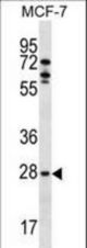 MLF1 Antibody western blot of MCF-7 cell line lysates (35 ug/lane). The MLF1 antibody detected the MLF1 protein (arrow).