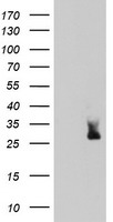HEK293T cells were transfected with the pCMV6-ENTRY control (Left lane) or pCMV6-ENTRY MLF2 (Right lane) cDNA for 48 hrs and lysed. Equivalent amounts of cell lysates (5 ug per lane) were separated by SDS-PAGE and immunoblotted with anti-MLF2.