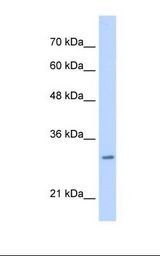 Jurkat cell lysate. Antibody concentration: 0.25 ug/ml. Gel concentration: 12%.