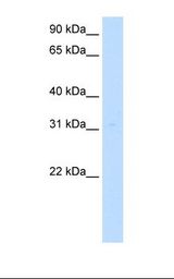 Transfected 293T cell lysate. Antibody concentration: 5.0 ug/ml. Gel concentration: 12%.