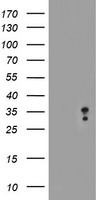 HEK293T cells were transfected with the pCMV6-ENTRY control (Left lane) or pCMV6-ENTRY MLF2 (Right lane) cDNA for 48 hrs and lysed. Equivalent amounts of cell lysates (5 ug per lane) were separated by SDS-PAGE and immunoblotted with anti-MLF2.