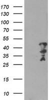 HEK293T cells were transfected with the pCMV6-ENTRY control (Left lane) or pCMV6-ENTRY MLF2 (Right lane) cDNA for 48 hrs and lysed. Equivalent amounts of cell lysates (5 ug per lane) were separated by SDS-PAGE and immunoblotted with anti-MLF2.