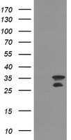 HEK293T cells were transfected with the pCMV6-ENTRY control (Left lane) or pCMV6-ENTRY MLF2 (Right lane) cDNA for 48 hrs and lysed. Equivalent amounts of cell lysates (5 ug per lane) were separated by SDS-PAGE and immunoblotted with anti-MLF2.