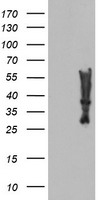 HEK293T cells were transfected with the pCMV6-ENTRY control (Left lane) or pCMV6-ENTRY MLF2 (Right lane) cDNA for 48 hrs and lysed. Equivalent amounts of cell lysates (5 ug per lane) were separated by SDS-PAGE and immunoblotted with anti-MLF2.