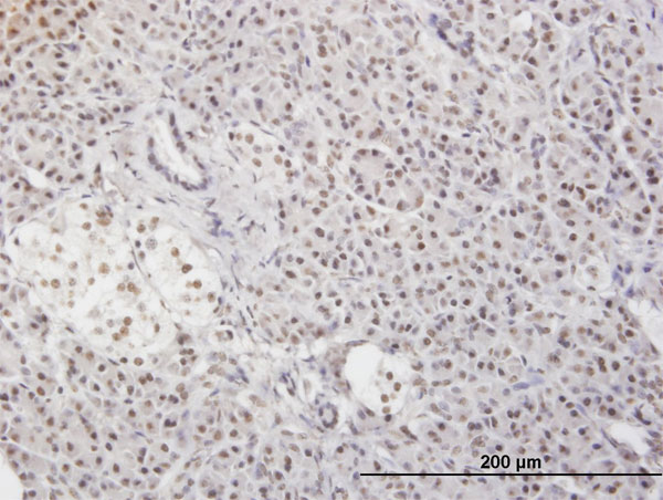 Immunoperoxidase of monoclonal antibody to MLF2 on formalin-fixed paraffin-embedded human pancreas. [antibody concentration 3 ug/ml]