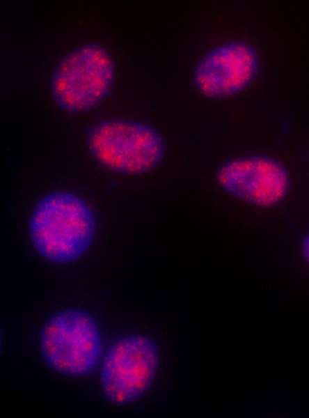 Detection of Human MLH3 by Immunocytochemistry. Sample: Formaldehyde-fixed asynchronous HeLa cells. Antibody: Affinity purified rabbit anti-MLH3 used at a dilution of 1:1000 (1 ug/ml). Detection: Red-fluorescent Goat anti-Rabbit IgG-heavy and light chain, cross-adsorbed Antibody DyLight 594 Conjugated used at a dilution of 1:100.