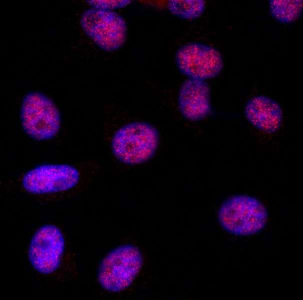 Detection of Human MLH3 by Immunocytochemistry. Sample: Formaldehyde-fixed asynchronous HeLa cells. Antibody: Affinity purified rabbit anti-MLH3 used at a dilution of 1:1000 (1 ug/ml). Detection: Red-fluorescent Goat anti-Rabbit IgG-heavy and light chain, cross-adsorbed Antibody DyLight 594 Conjugated used at a dilution of 1:100.