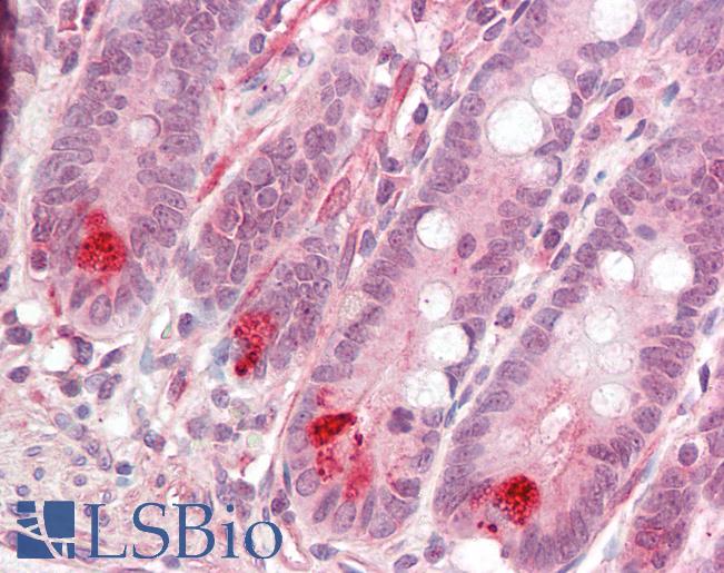 Anti-MLIP antibody IHC staining of human small intestine. Immunohistochemistry of formalin-fixed, paraffin-embedded tissue after heat-induced antigen retrieval.