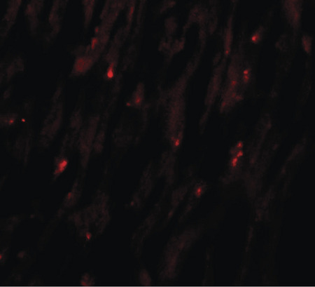 Immunofluorescence of MLIP in human heart tissue with MLIP antibody at 20 ug/ml.