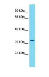 Western blot of Human HepG2. MLIP antibody dilution 1.0 ug/ml.