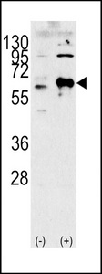 Western blot of lysates from K562, Ramos cell line (from left to right), using MLK4 Antibody. Antibody was diluted at 1:1000 at each lane. A goat anti-rabbit IgG H&L (HRP) at 1:5000 dilution was used as the secondary antibody. Lysates at 35ug per lane.