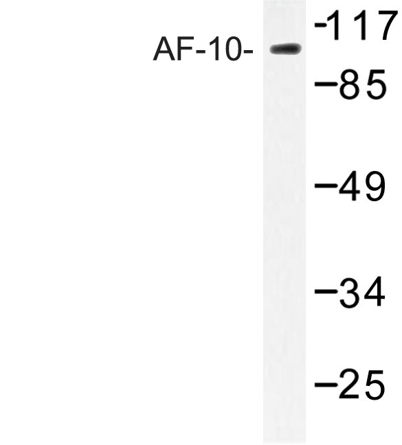 Western blot of AF-10 (E237) pAb in extracts from COLO205 cells.