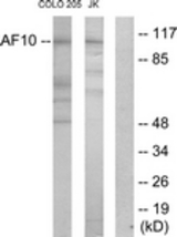 Western blot of extracts from COLO205/Jurkat cells, using AF10 Antibody. The lane on the right is treated with the synthesized peptide.