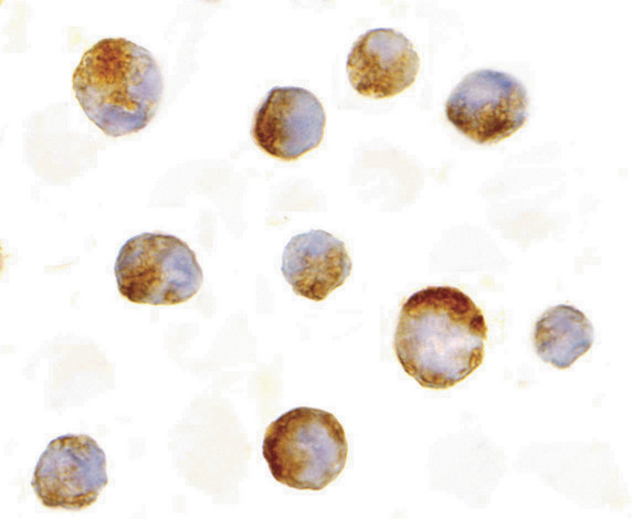 Immunocytochemistry of Mcl-1 in Raji cells with Mcl-1 antibody at 10 ug/ml.