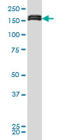 MLLT10 monoclonal antibody (M01), clone 6H8 Western Blot analysis of MLLT10 expression in HeLa NE.