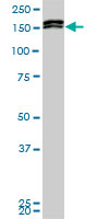 MLLT10 monoclonal antibody (M01), clone 6H8. Western Blot analysis of MLLT10 expression in PC-12.