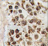 Formalin-fixed and paraffin-embedded human testis tissue reacted with MLLT10 antibody , which was peroxidase-conjugated to the secondary antibody, followed by DAB staining. This data demonstrates the use of this antibody for immunohistochemistry; clinical relevance has not been evaluated.