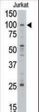 Western blot of anti-MLLT10 antibody in Jurkat cell line lysate. MLLT10(arrow) was detected using the purified antibody.